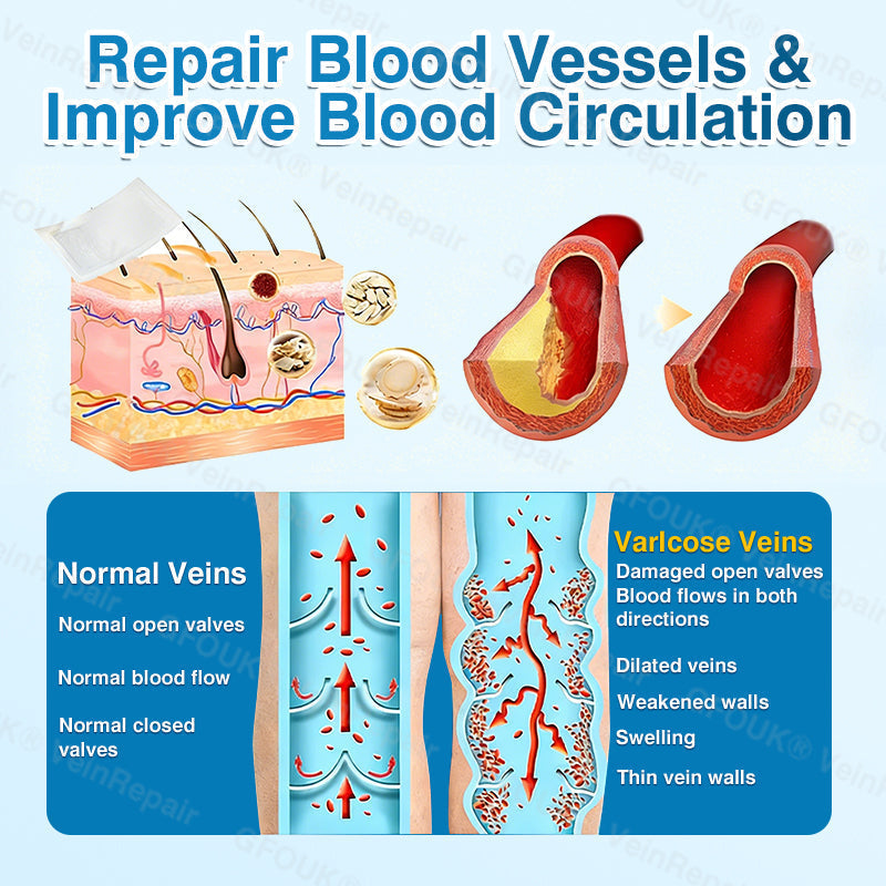 🇺🇸🏆✅️🏃GFOUK® VeinRepair Microneedle Patch Roll⚡Instant Relief, Long-Term Results