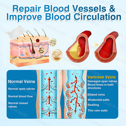 🇺🇸🏆✅️🏃GFOUK® VeinRepair Microneedle Patch Roll⚡Instant Relief, Long-Term Results