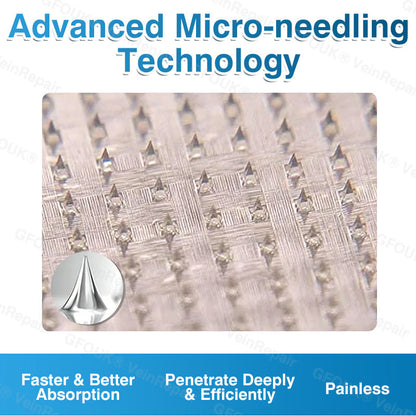 🇺🇸🏆✅️🏃GFOUK® VeinRepair Microneedle Patch Roll⚡Instant Relief, Long-Term Results