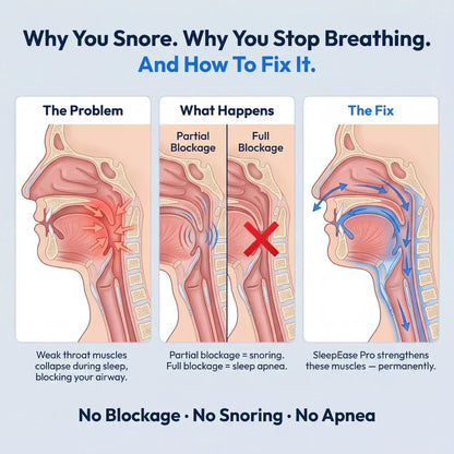 Pryxo™ —Intelligent Pulse Anti-Snoring Device